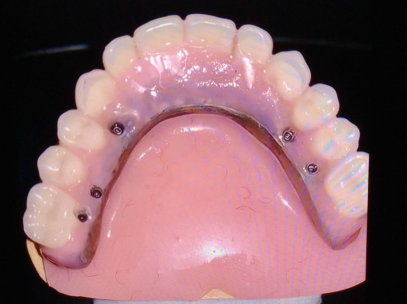 Express Dental Lab